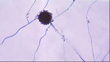 Imagem ilustrativa de fungo do gênero Aspergillus - Wikimedia Commons via Domínio Público